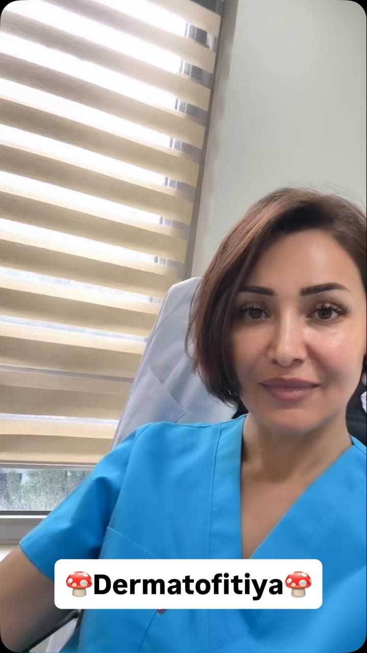 Dr. Aygün Mustafayeva qasıq dermatofitiyası haqqında videoda